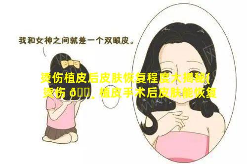 烫伤植皮后皮肤恢复程度大揭秘(烫伤 🌸 植皮手术后皮肤能恢复到什么程度)